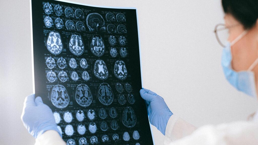 Enfermedades neurodegenerativas